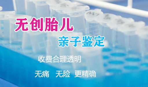 雅安怀孕几个月如何确认孩子父亲是谁,雅安孕期亲子鉴定如何收费 雅安怀孕几个月如何确认孩子父亲是谁,雅安孕期亲子鉴定如何收费